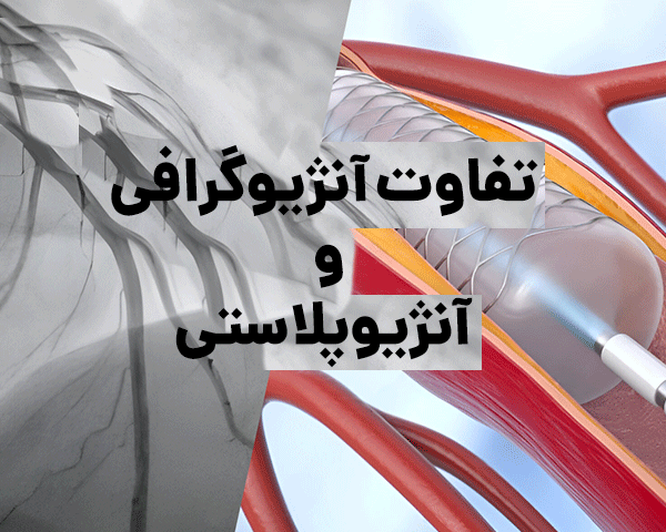 تفاوت آنژیوگرافی و آنژیوپلاستی