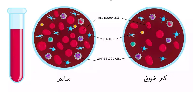 بیماری کم خونی